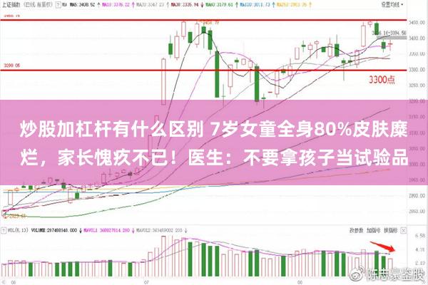 炒股加杠杆有什么区别 7岁女童全身80%皮肤糜烂，家长愧疚不已！医生：不要拿孩子当试验品